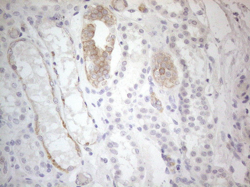 ERBB3 Antibody in Immunohistochemistry (Paraffin) (IHC (P))