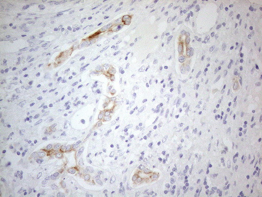 ERBB3 Antibody in Immunohistochemistry (Paraffin) (IHC (P))