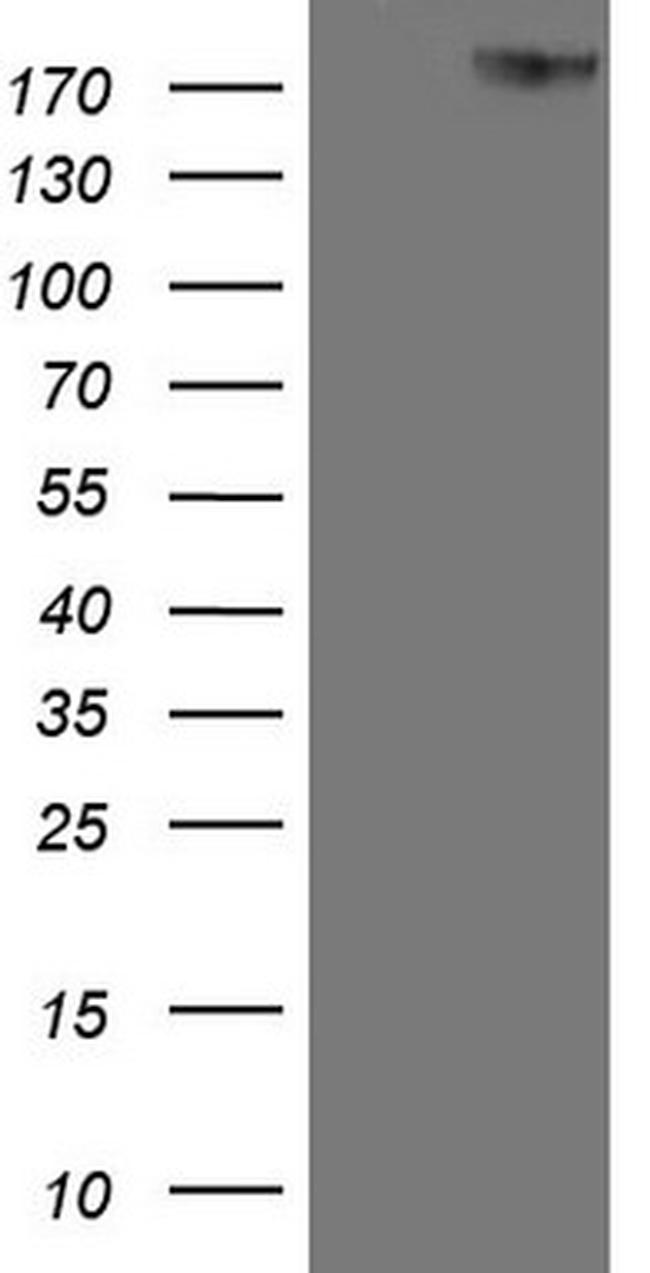 ERBB3 Antibody in Western Blot (WB)