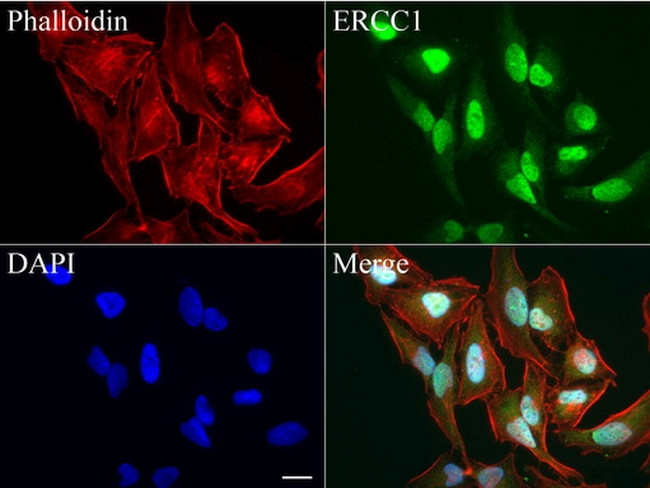 ERCC1 Antibody in Immunocytochemistry (ICC/IF)