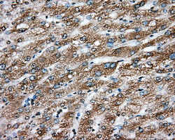 ERCC1 Antibody in Immunohistochemistry (Paraffin) (IHC (P))