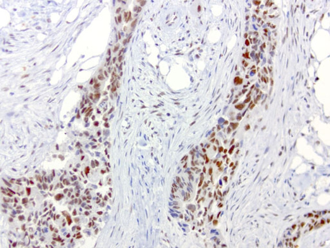 ERCC1 Antibody in Immunohistochemistry (Paraffin) (IHC (P))