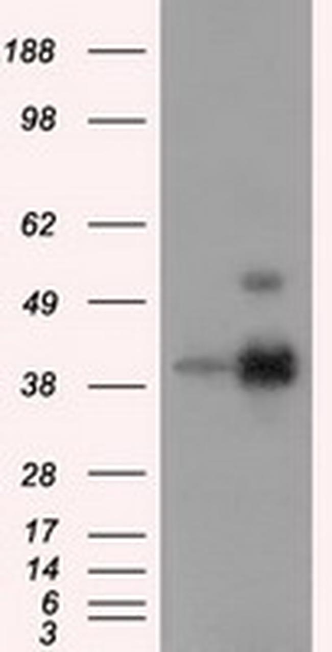 ERCC1 Antibody in Western Blot (WB)