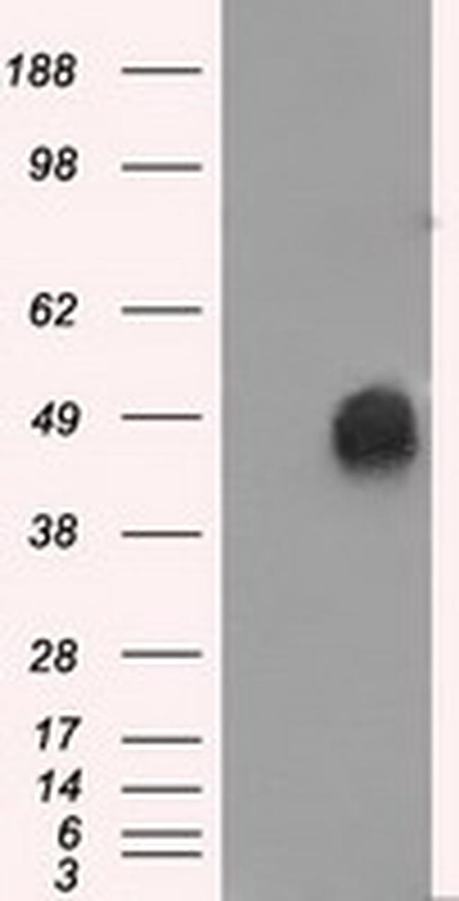 ERCC1 Antibody in Western Blot (WB)