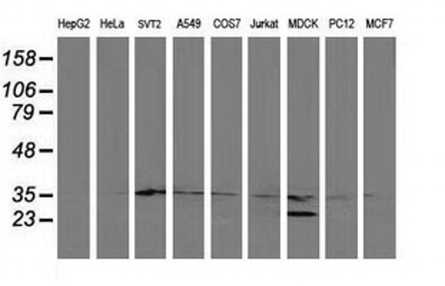 ERCC1 Antibody in Western Blot (WB)