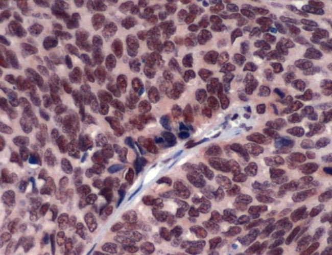 ERCC1 Antibody in Immunohistochemistry (IHC)