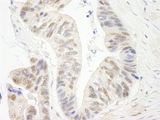 ERCC5/XPG Antibody in Immunohistochemistry (IHC)