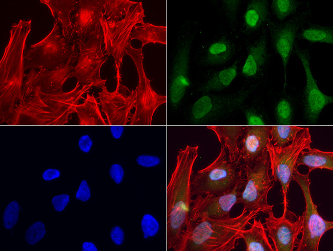 ERG Antibody in Immunocytochemistry (ICC/IF)