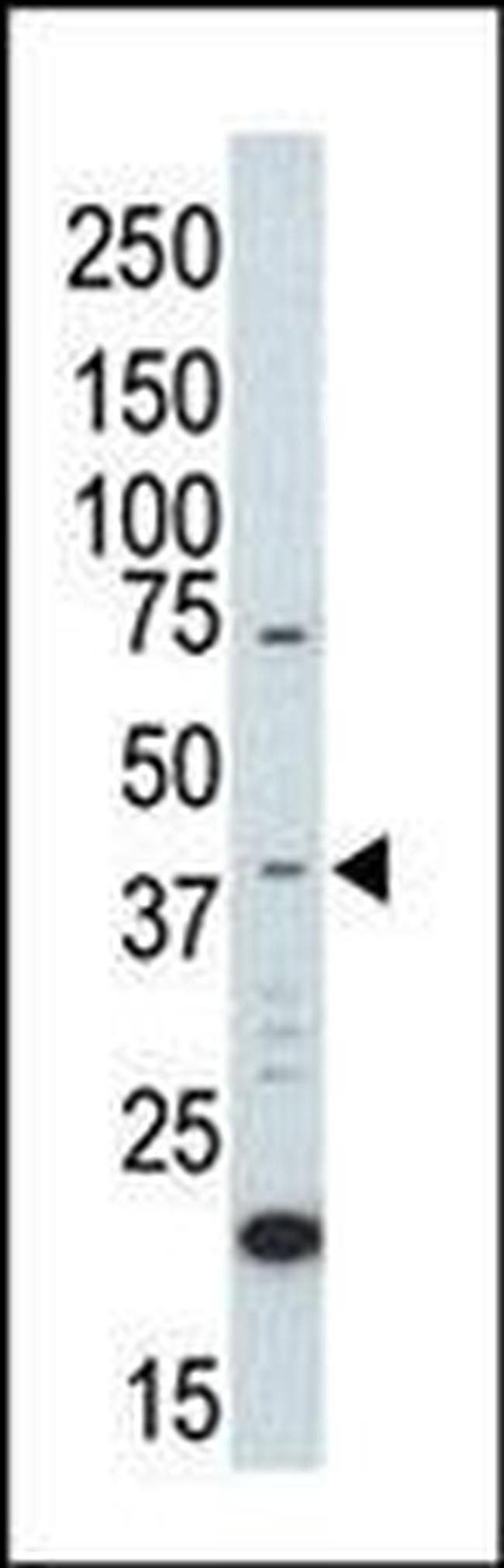 ERK2 Antibody in Western Blot (WB)