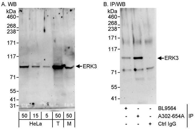 ERK3 Antibody in Western Blot (WB)