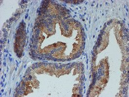 ESR1 Antibody in Immunohistochemistry (Paraffin) (IHC (P))