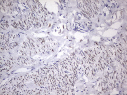 ESR1 Antibody in Immunohistochemistry (Paraffin) (IHC (P))