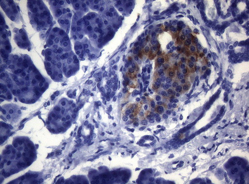 ESRRA Antibody in Immunohistochemistry (Paraffin) (IHC (P))