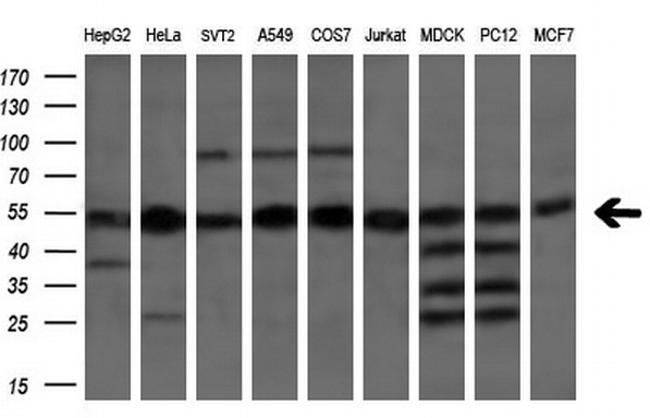 ETF1 Antibody in Western Blot (WB)