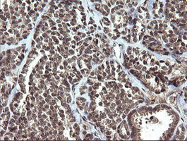 ETS2 Antibody in Immunohistochemistry (Paraffin) (IHC (P))