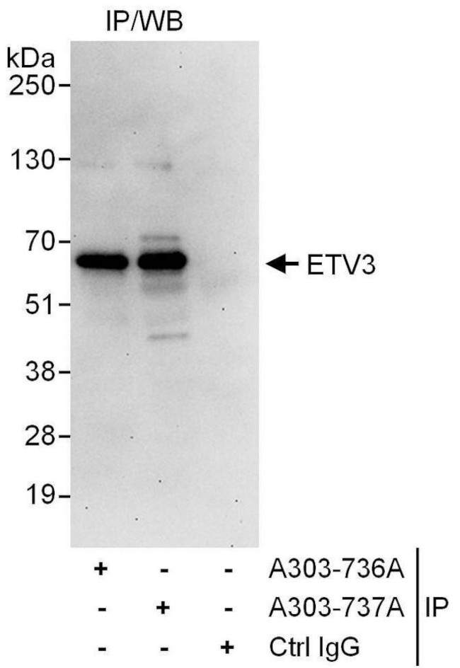 ETV3 Antibody in Immunoprecipitation (IP)