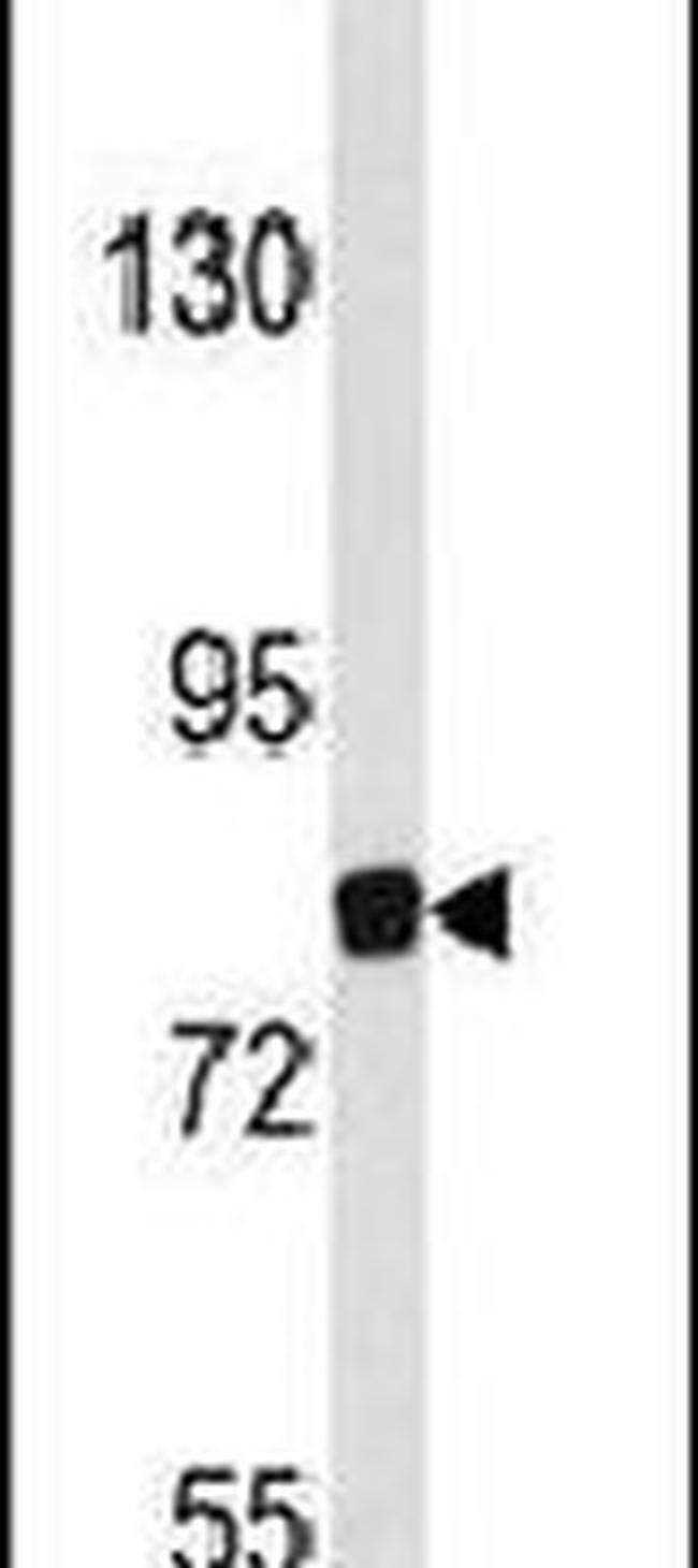 EVI5 Antibody in Western Blot (WB)