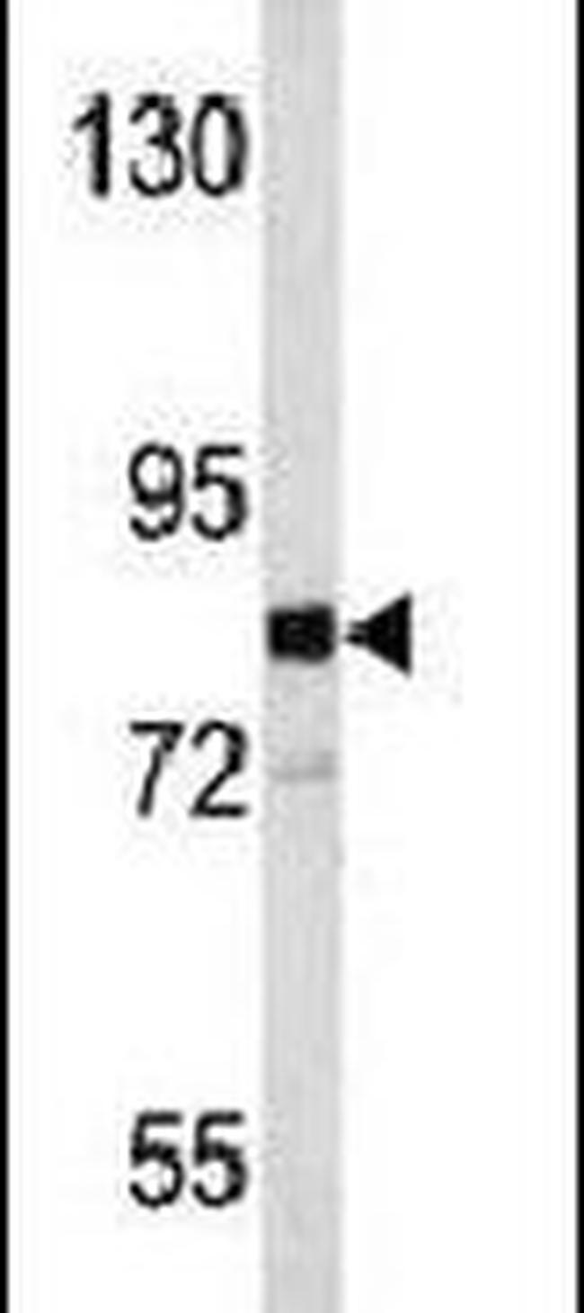 EVI5 Antibody in Western Blot (WB)