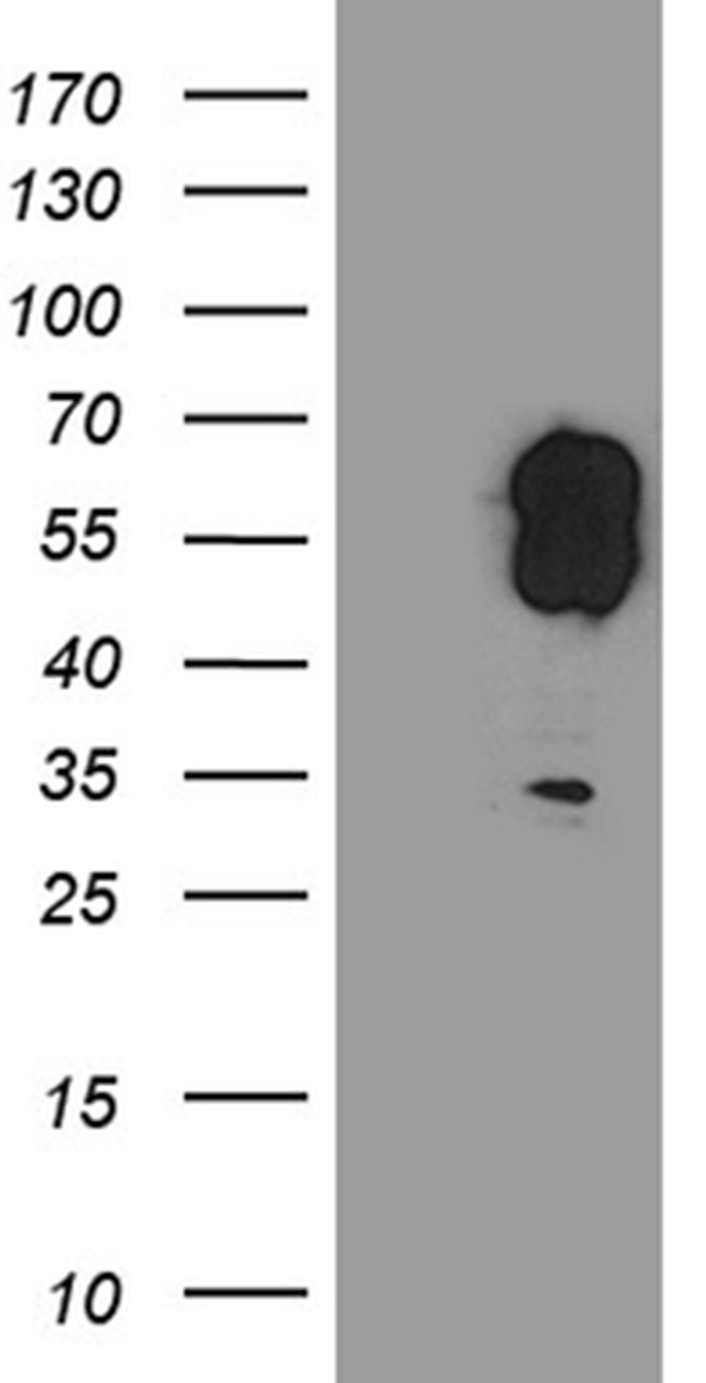 EVX1 Antibody in Western Blot (WB)