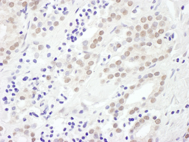 EXOSC10 Antibody in Immunohistochemistry (IHC)