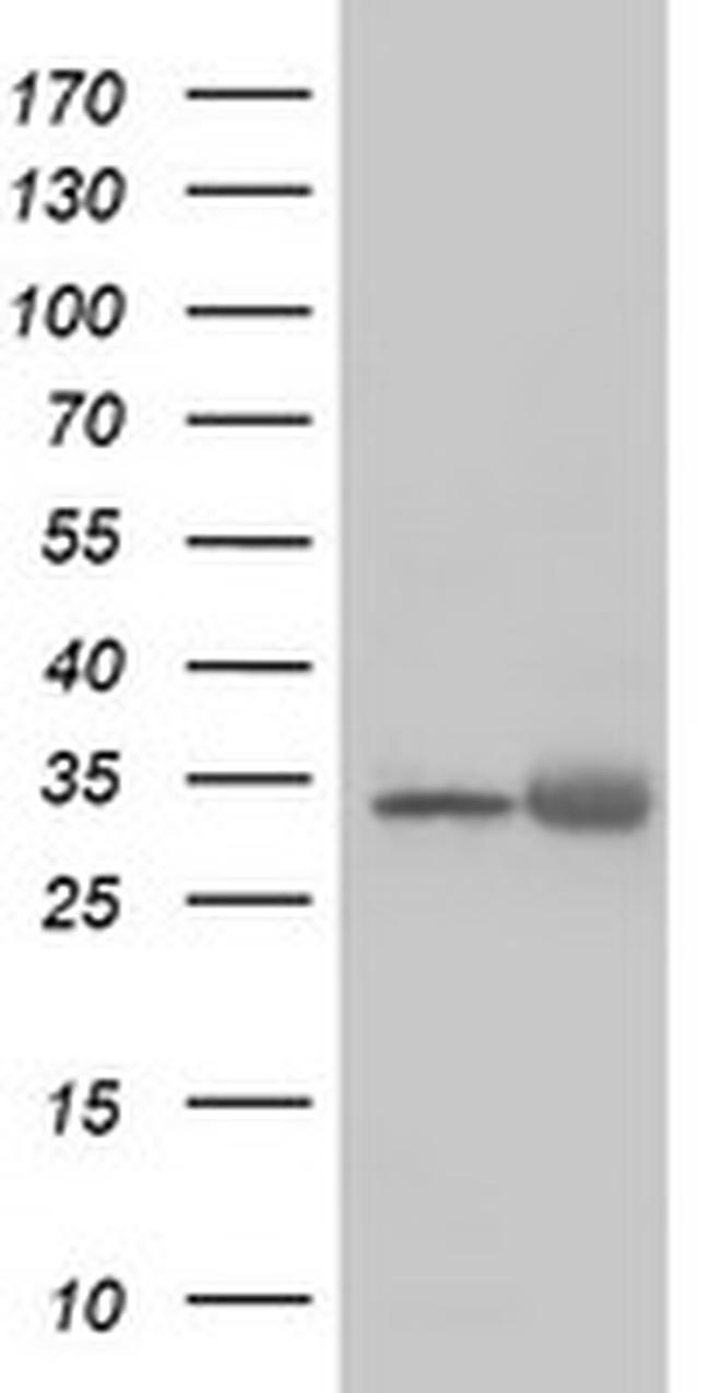 EXOSC7 Antibody in Western Blot (WB)