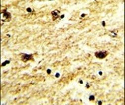 EXOSC8 Antibody in Immunohistochemistry (IHC)