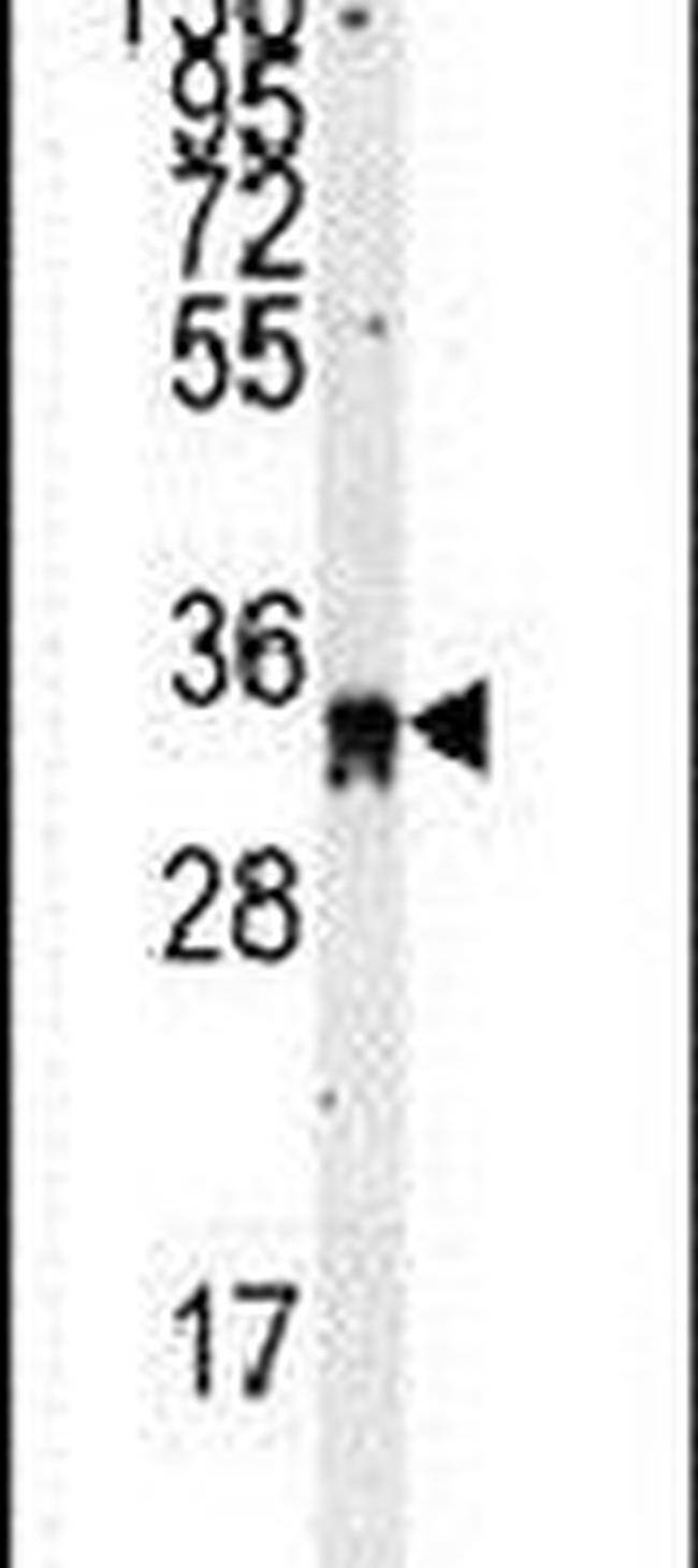 EXOSC8 Antibody in Western Blot (WB)