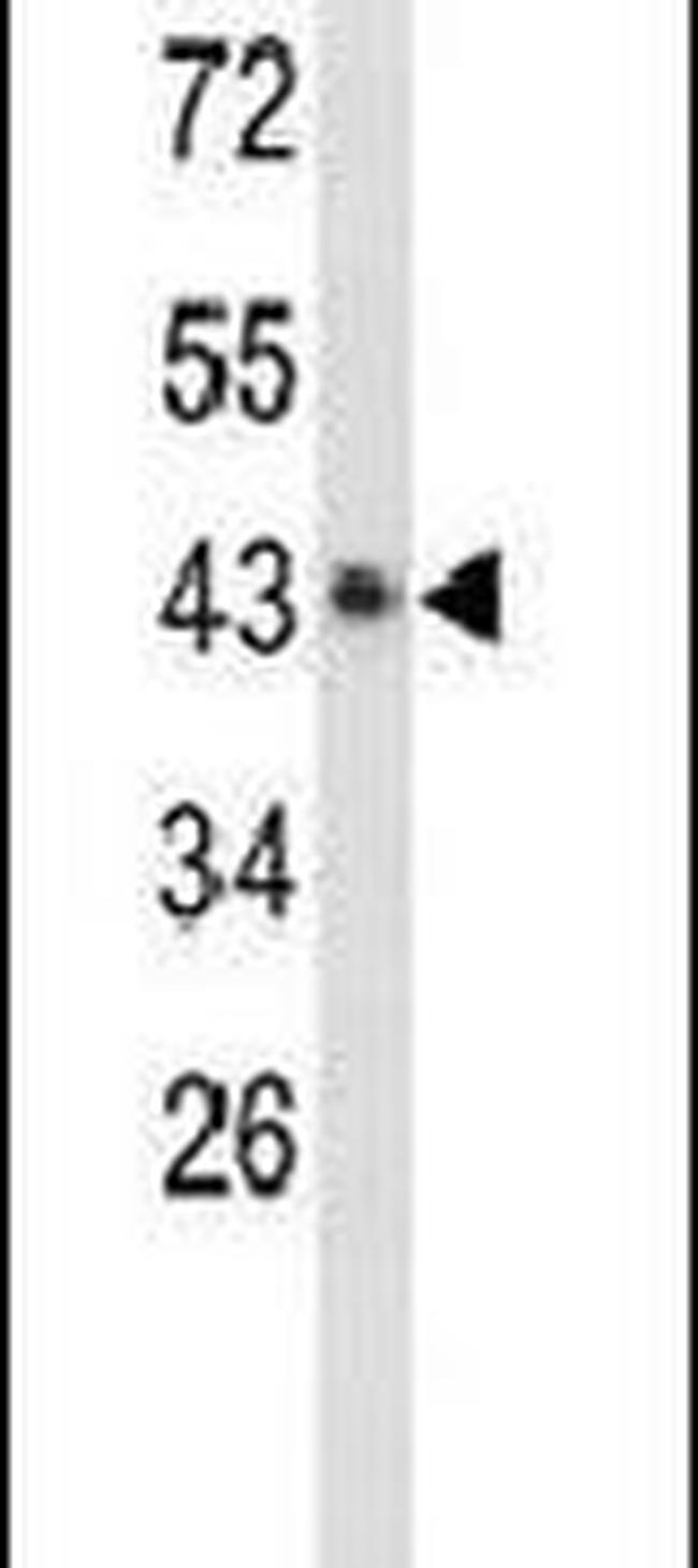 EXTL2 Antibody in Western Blot (WB)