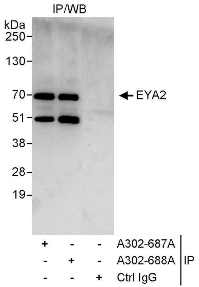 EYA2 Antibody in Immunoprecipitation (IP)