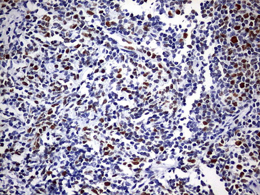 EZH2 Antibody in Immunohistochemistry (Paraffin) (IHC (P))