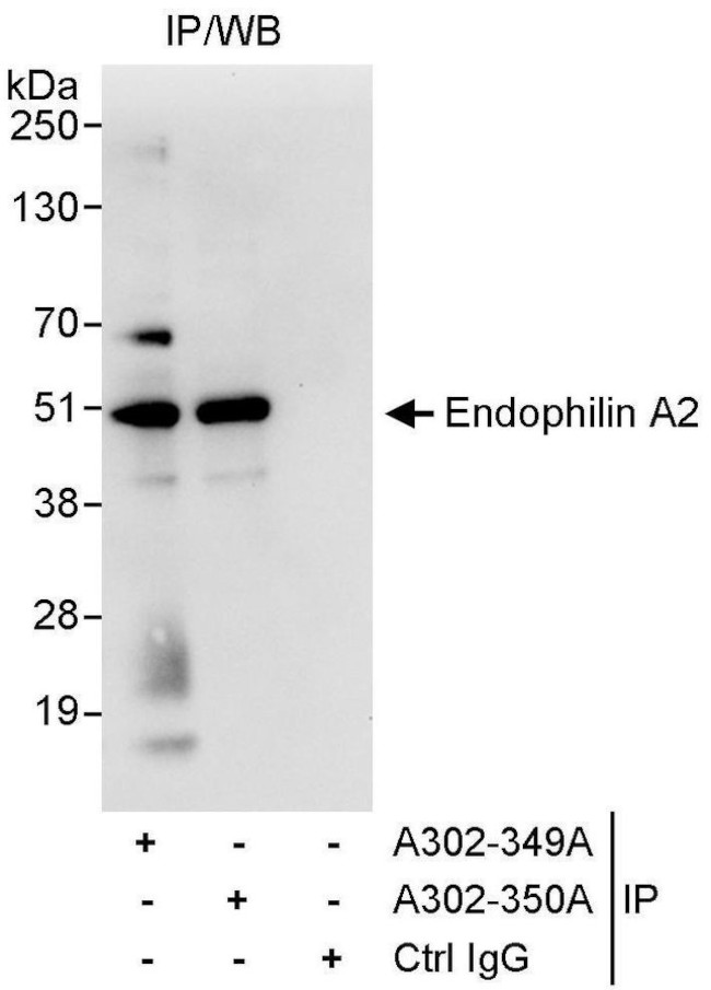 Endophilin A2 Antibody in Immunoprecipitation (IP)