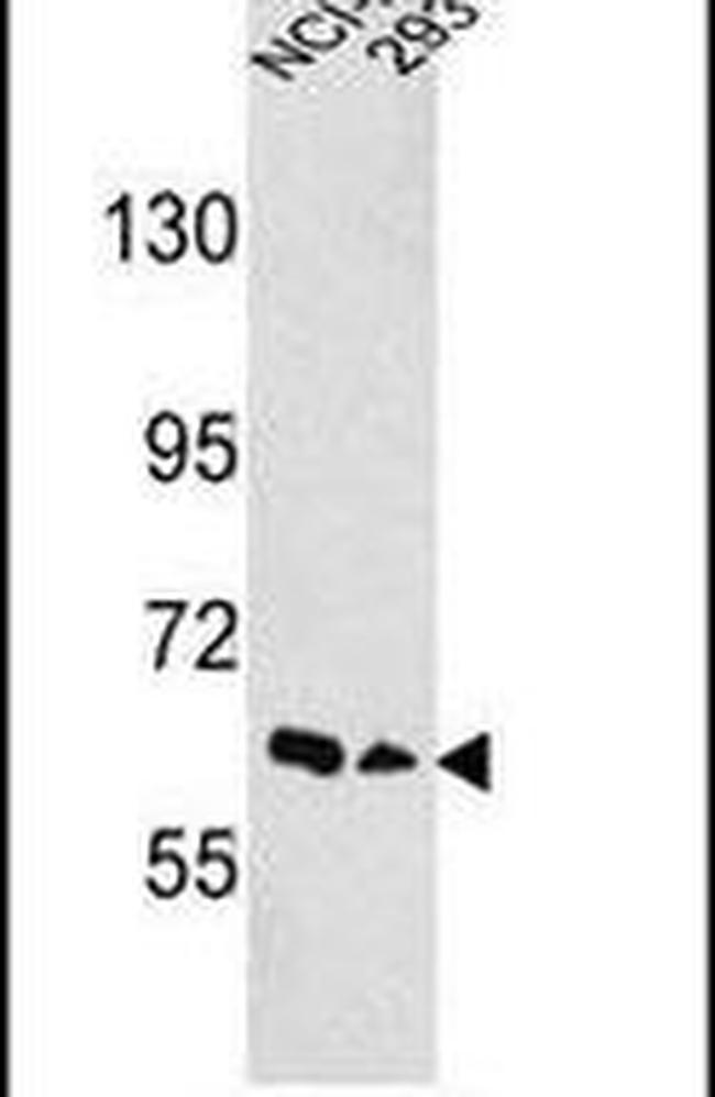 EphA3 Antibody in Western Blot (WB)