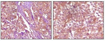 EphB4 Antibody in Immunohistochemistry (Paraffin) (IHC (P))