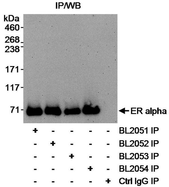 Estrogen Receptor Alpha Antibody in Immunoprecipitation (IP)