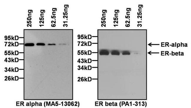 Estrogen Receptor alpha Antibody in Western Blot (WB)