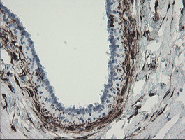 F13A1 Antibody in Immunohistochemistry (Paraffin) (IHC (P))