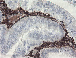 F13A1 Antibody in Immunohistochemistry (Paraffin) (IHC (P))