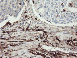 F13A1 Antibody in Immunohistochemistry (Paraffin) (IHC (P))