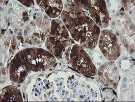 F13A1 Antibody in Immunohistochemistry (Paraffin) (IHC (P))