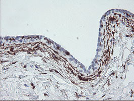 F13A1 Antibody in Immunohistochemistry (Paraffin) (IHC (P))