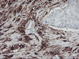 F13A1 Antibody in Immunohistochemistry (Paraffin) (IHC (P))