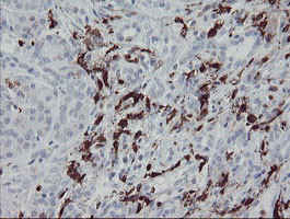 F13A1 Antibody in Immunohistochemistry (Paraffin) (IHC (P))