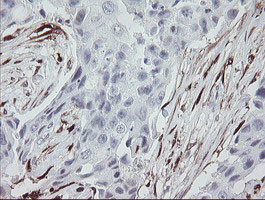 F13A1 Antibody in Immunohistochemistry (Paraffin) (IHC (P))