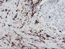 F13A1 Antibody in Immunohistochemistry (Paraffin) (IHC (P))