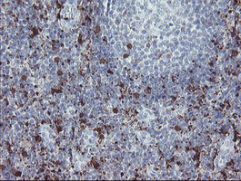 F13A1 Antibody in Immunohistochemistry (Paraffin) (IHC (P))