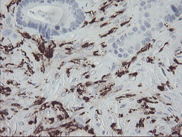 F13A1 Antibody in Immunohistochemistry (Paraffin) (IHC (P))