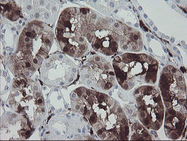 F13A1 Antibody in Immunohistochemistry (Paraffin) (IHC (P))