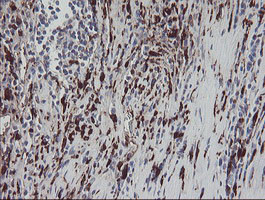 F13A1 Antibody in Immunohistochemistry (Paraffin) (IHC (P))