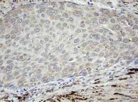 F13A1 Antibody in Immunohistochemistry (Paraffin) (IHC (P))