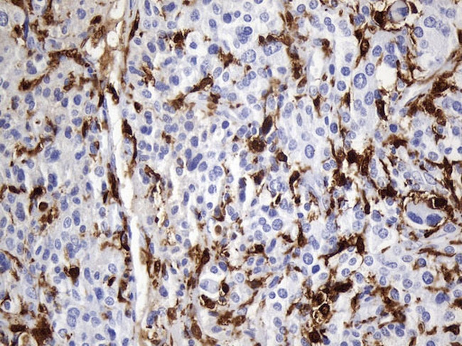 F13A1 Antibody in Immunohistochemistry (Paraffin) (IHC (P))